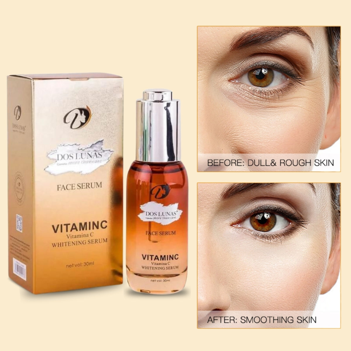 Serum Renova: Tratamiento Antiacné y Rejuvenecedor